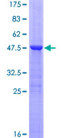 RGS8 Protein - 12.5% SDS-PAGE of human RGS8 stained with Coomassie Blue