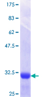 RGS8 Protein - 12.5% SDS-PAGE Stained with Coomassie Blue.