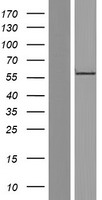 RGS9 Protein - Western validation with an anti-DDK antibody * L: Control HEK293 lysate R: Over-expression lysate