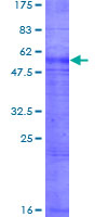 RHAG Protein - 12.5% SDS-PAGE of human RHAG stained with Coomassie Blue