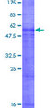 RHAG Protein - 12.5% SDS-PAGE of human RHAG stained with Coomassie Blue