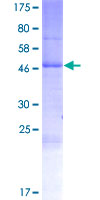 RHBDD2 Protein - 12.5% SDS-PAGE of human RHBDD2 stained with Coomassie Blue
