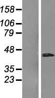 RHBDD3 Protein - Western validation with an anti-DDK antibody * L: Control HEK293 lysate R: Over-expression lysate