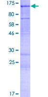 RHBDF1 Protein - 12.5% SDS-PAGE of human RHBDF1 stained with Coomassie Blue