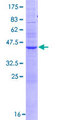 RHBDL2 / RRP2 Protein - 12.5% SDS-PAGE of human RHBDL2 stained with Coomassie Blue