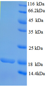 RHBDL2 / RRP2 Protein