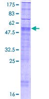 RHBDL3 Protein - 12.5% SDS-PAGE of human RHBDL3 stained with Coomassie Blue