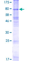 RHCG Protein - 12.5% SDS-PAGE of human RHCG stained with Coomassie Blue