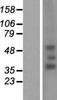 RHD Protein - Western validation with an anti-DDK antibody * L: Control HEK293 lysate R: Over-expression lysate