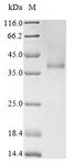 RHD Protein - (Tris-Glycine gel) Discontinuous SDS-PAGE (reduced) with 5% enrichment gel and 15% separation gel.