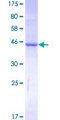 RHEB Protein - 12.5% SDS-PAGE of human RHEB stained with Coomassie Blue
