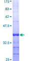 RHEBL1 Protein - 12.5% SDS-PAGE Stained with Coomassie Blue.