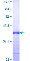 Rho Kinase / ROCK1 Protein - 12.5% SDS-PAGE Stained with Coomassie Blue.