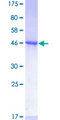 RHOA Protein - 12.5% SDS-PAGE of human RHOA stained with Coomassie Blue