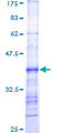 RHOA Protein - 12.5% SDS-PAGE Stained with Coomassie Blue.