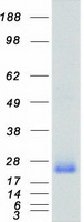 RHOA Protein - Purified recombinant protein RHOA was analyzed by SDS-PAGE gel and Coomassie Blue Staining