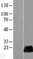 RHOB Protein - Western validation with an anti-DDK antibody * L: Control HEK293 lysate R: Over-expression lysate