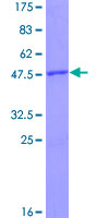 RHOB Protein - 12.5% SDS-PAGE of human RHOB stained with Coomassie Blue