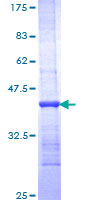 RHOB Protein - 12.5% SDS-PAGE Stained with Coomassie Blue.