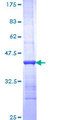 RHOB Protein - 12.5% SDS-PAGE Stained with Coomassie Blue.