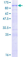 RHOBTB1 Protein - 12.5% SDS-PAGE of human RHOBTB1 stained with Coomassie Blue