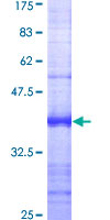 RHOBTB1 Protein - 12.5% SDS-PAGE Stained with Coomassie Blue.