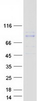 RHOBTB1 Protein - Purified recombinant protein RHOBTB1 was analyzed by SDS-PAGE gel and Coomassie Blue Staining