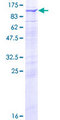 RHOBTB2 / DBC2 Protein - 12.5% SDS-PAGE of human RHOBTB2 stained with Coomassie Blue