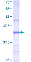 RHOBTB2 / DBC2 Protein - 12.5% SDS-PAGE Stained with Coomassie Blue.