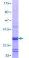 RHOBTB3 Protein - 12.5% SDS-PAGE Stained with Coomassie Blue.
