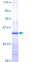 RHOC Protein - 12.5% SDS-PAGE Stained with Coomassie Blue.