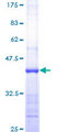 RHOC Protein - 12.5% SDS-PAGE Stained with Coomassie Blue.