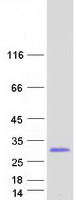 RHOC Protein - Purified recombinant protein RHOC was analyzed by SDS-PAGE gel and Coomassie Blue Staining