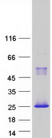 RHOC Protein - Purified recombinant protein RHOC was analyzed by SDS-PAGE gel and Coomassie Blue Staining