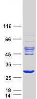 RHOD Protein - Purified recombinant protein RHOD was analyzed by SDS-PAGE gel and Coomassie Blue Staining