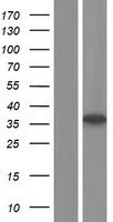Rhodanese / TST Protein - Western validation with an anti-DDK antibody * L: Control HEK293 lysate R: Over-expression lysate