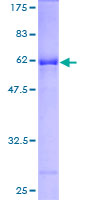 Rhodanese / TST Protein - 12.5% SDS-PAGE of human TST stained with Coomassie Blue