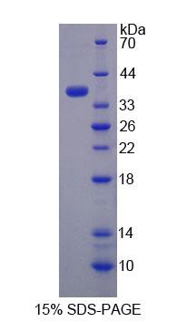 Rhodanese / TST Protein - Recombinant Thiosulfate Sulfurtransferase (TST) by SDS-PAGE