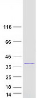 Rhodanese / TST Protein - Purified recombinant protein TST was analyzed by SDS-PAGE gel and Coomassie Blue Staining