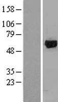 Rhodopsin Kinase / GRK1 Protein - Western validation with an anti-DDK antibody * L: Control HEK293 lysate R: Over-expression lysate
