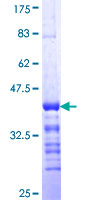 Rhodopsin Kinase / GRK1 Protein - 12.5% SDS-PAGE Stained with Coomassie Blue.