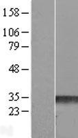 RHOE / RND3 Protein - Western validation with an anti-DDK antibody * L: Control HEK293 lysate R: Over-expression lysate