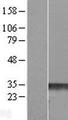 RHOE / RND3 Protein - Western validation with an anti-DDK antibody * L: Control HEK293 lysate R: Over-expression lysate