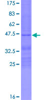 RHOG / ARHG Protein - 12.5% SDS-PAGE of human RHOG stained with Coomassie Blue