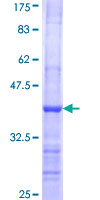RHOG / ARHG Protein - 12.5% SDS-PAGE Stained with Coomassie Blue.