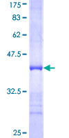 RHOQ / TC10 Protein - 12.5% SDS-PAGE Stained with Coomassie Blue.