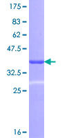 RHOT1 Protein - 12.5% SDS-PAGE Stained with Coomassie Blue.