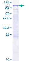 RHOT2 Protein - 12.5% SDS-PAGE of human RHOT2 stained with Coomassie Blue