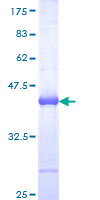 RHOT2 Protein - 12.5% SDS-PAGE Stained with Coomassie Blue.