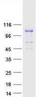 RHOT2 Protein - Purified recombinant protein RHOT2 was analyzed by SDS-PAGE gel and Coomassie Blue Staining